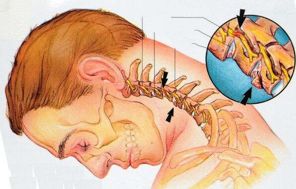 Сохтори vertebrae cervical